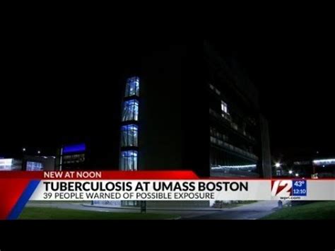Health officials investigating case of tuberculosis within UMass Boston community